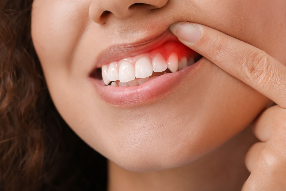 How to Get Rid of Toothache