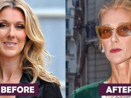 Celine Dion Before And After Weight Loss Photos