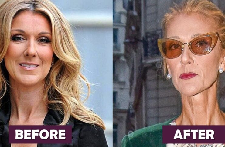 Celine Dion Before And After Weight Loss Photos