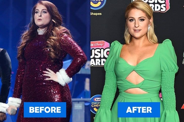 Meghan-Trainor-Before-And-After