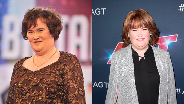 Susan Boyle Weight Loss Before And After